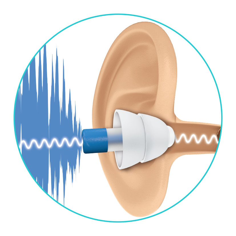 Bouchon d'oreilles antibruit avec filtre Plic audio - Spécial